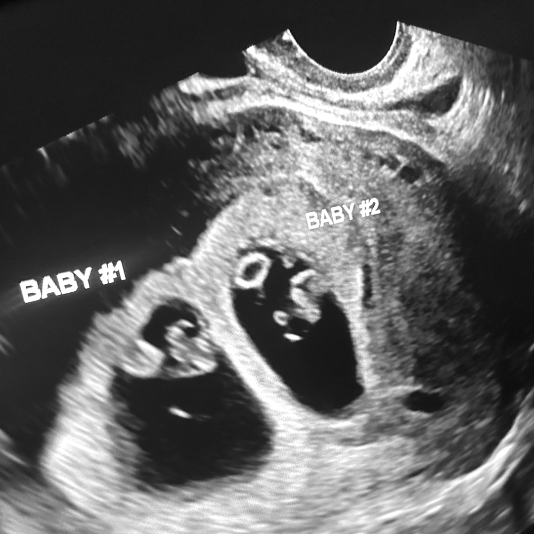 Photo shared by Chantel for their Babylist baby registry.