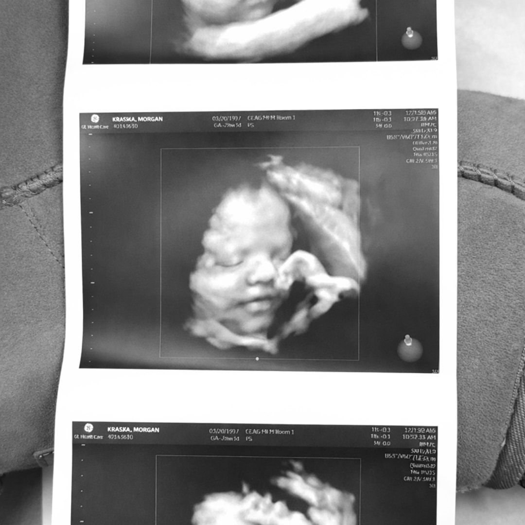 Photo shared by Morgan for their Babylist baby registry.