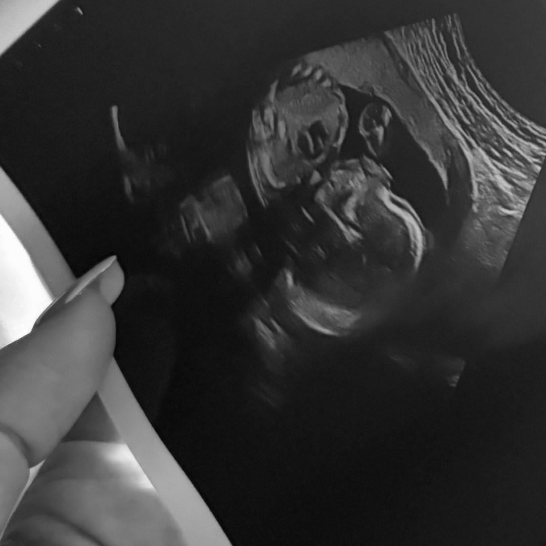 Photo shared by Ana Malia for their Babylist baby registry.