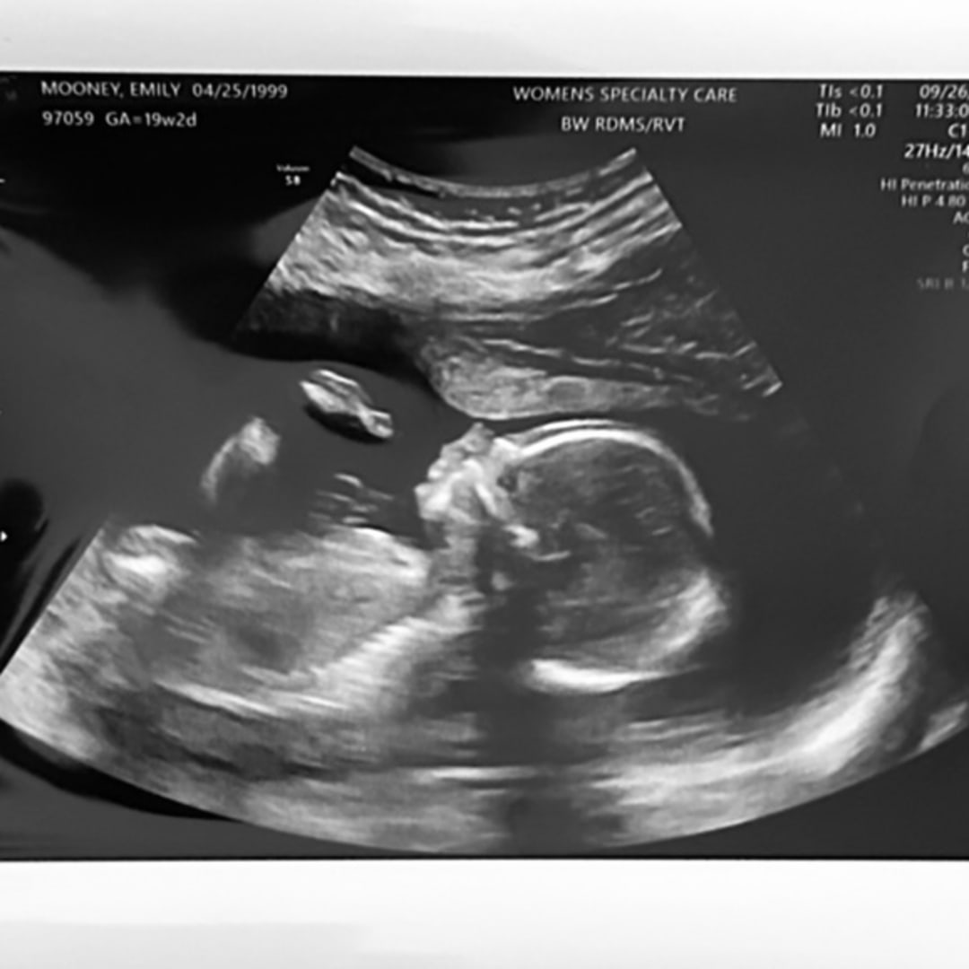 Photo shared by Emily for their Babylist baby registry.