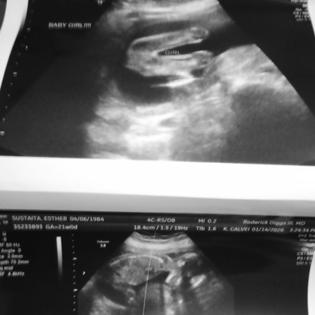 Photo shared by Esther for their Babylist baby registry.