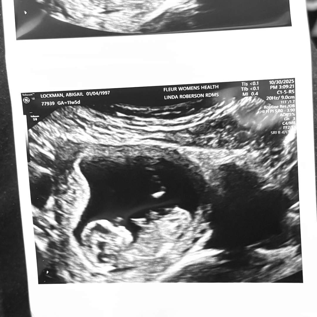 Photo shared by Abigail for their Babylist baby registry.