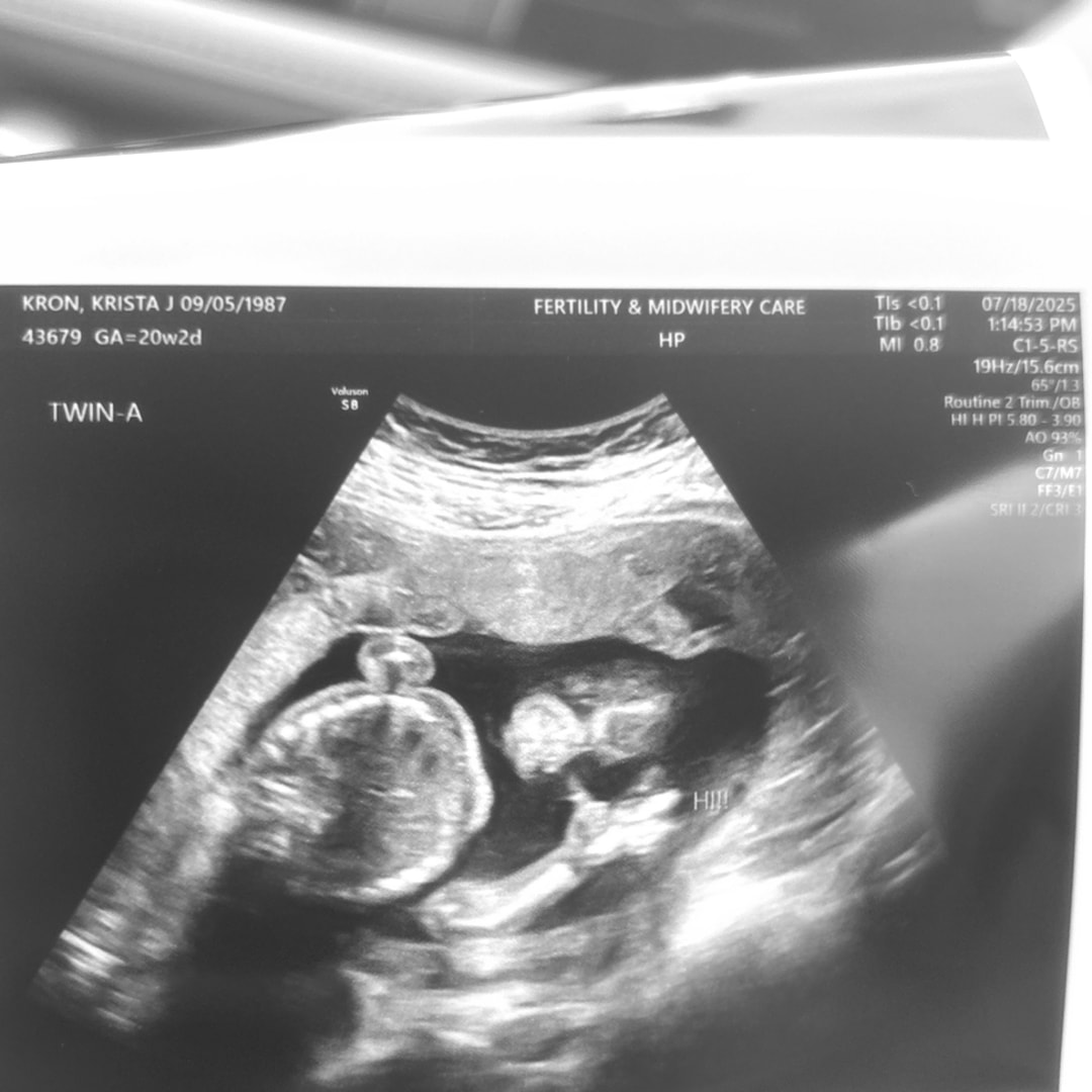 Photo shared by Krista for their Babylist baby registry.