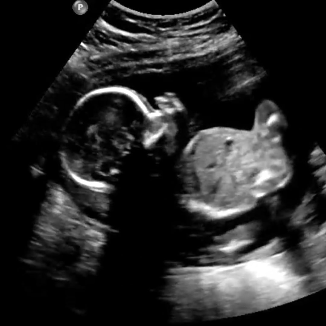 Photo shared by Nicole for their Babylist baby registry.