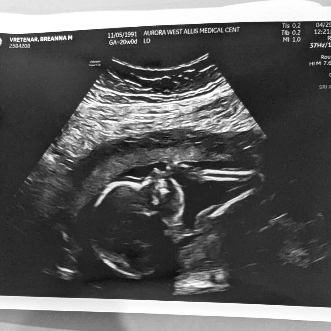 Photo shared by Breanna for their Babylist baby registry.