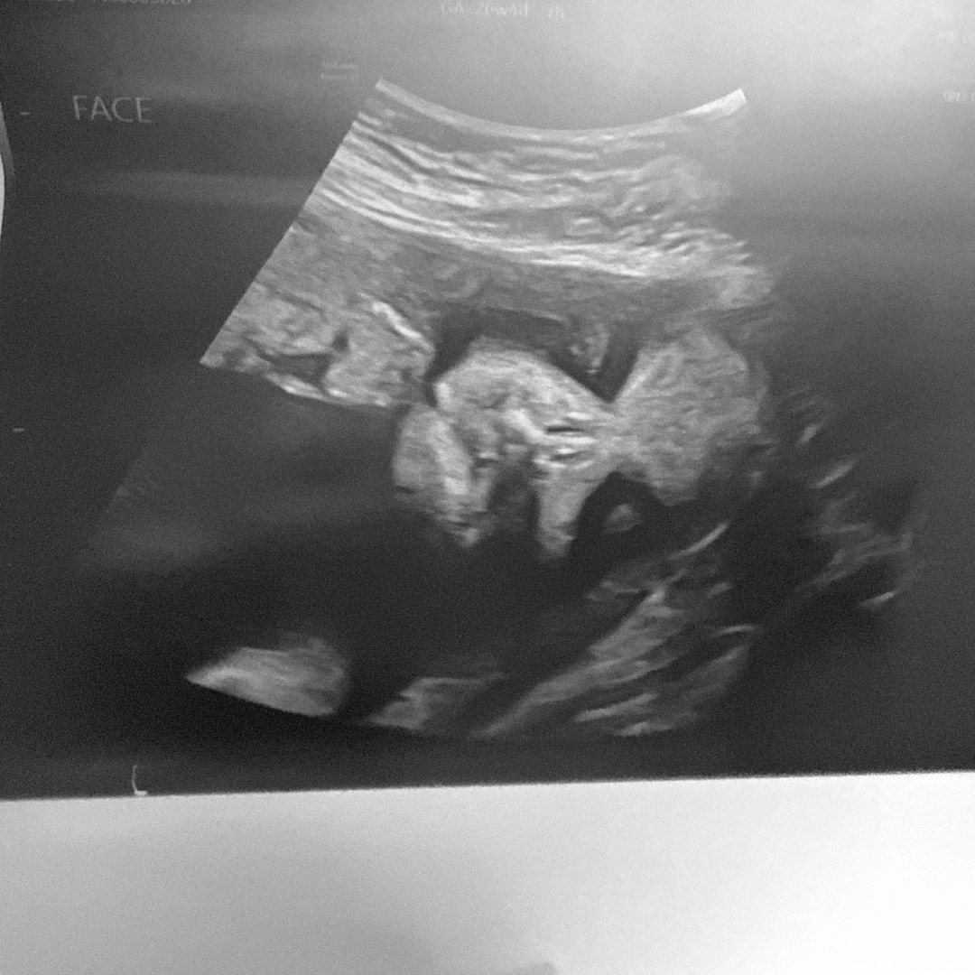 Photo shared by Bryyana for their Babylist baby registry.