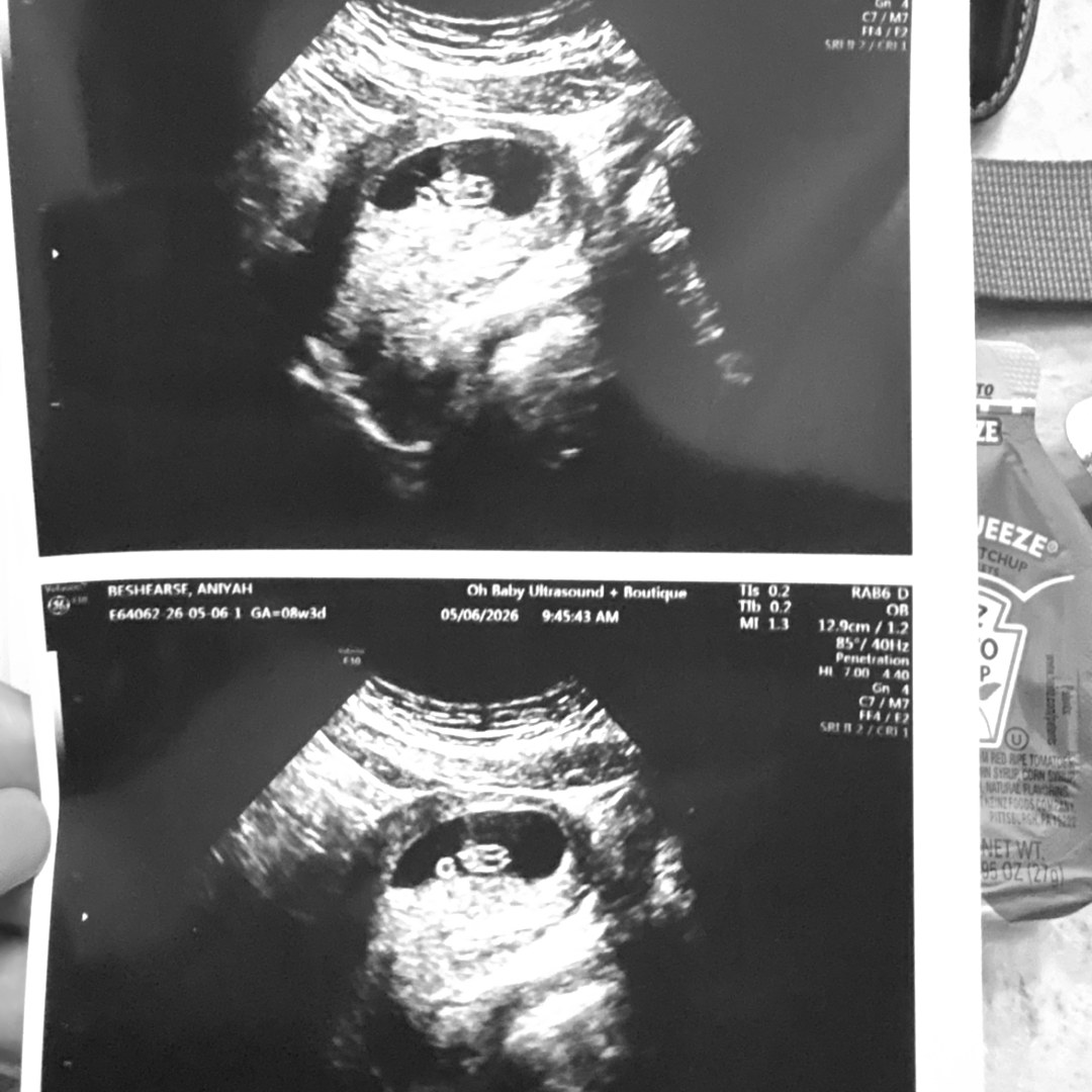 Photo shared by Aniyah for their Babylist baby registry.