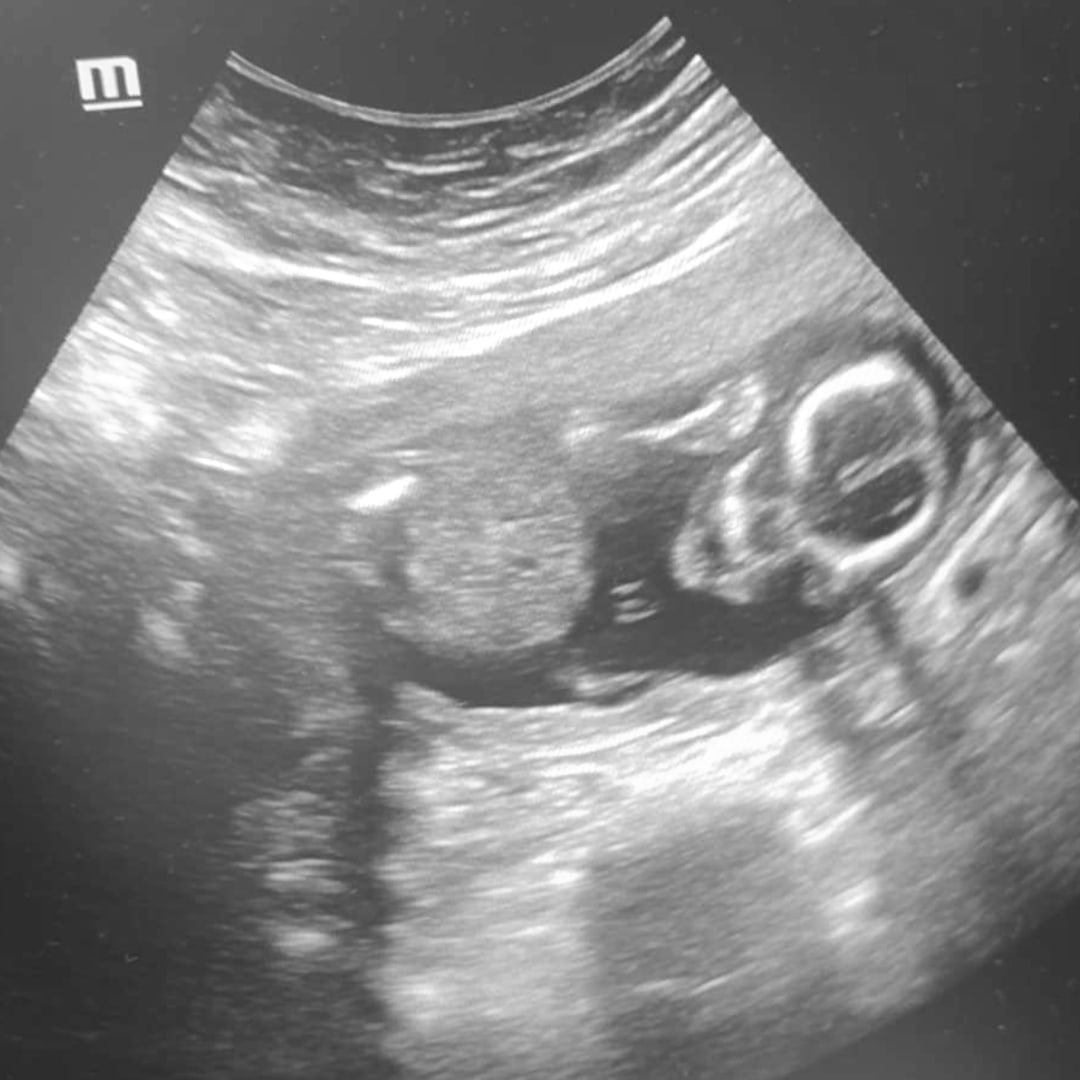 Photo shared by Alizay for their Babylist baby registry.