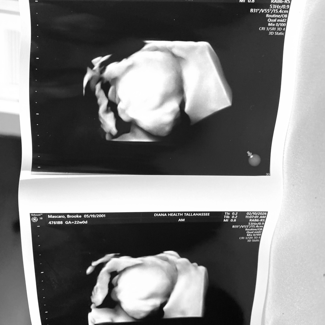 Photo shared by Brooke for their Babylist baby registry.