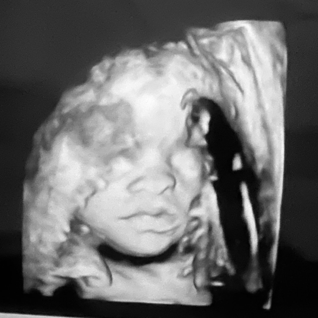 Photo shared by Julianna for their Babylist baby registry.