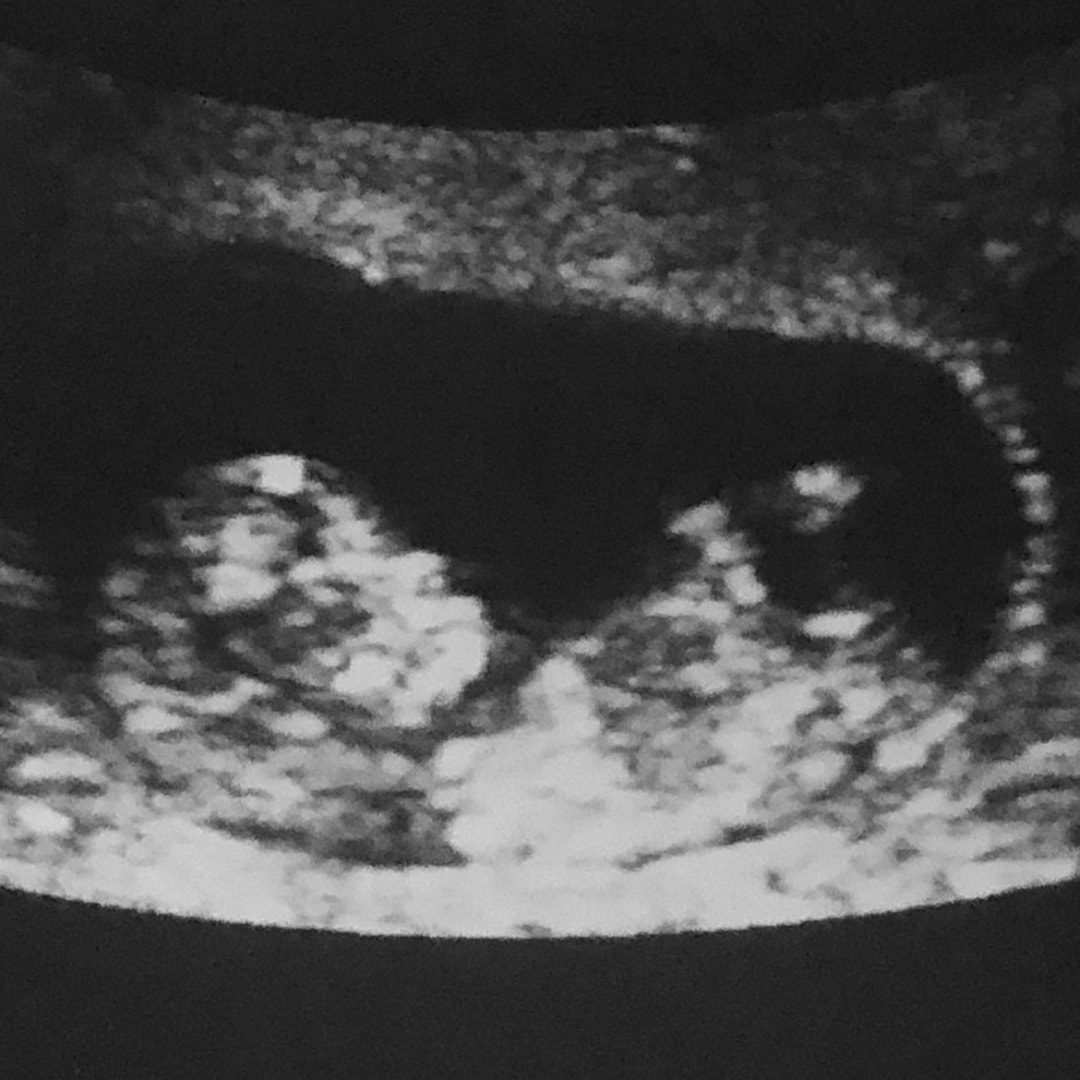 Photo shared by Brenda for their Babylist baby registry.