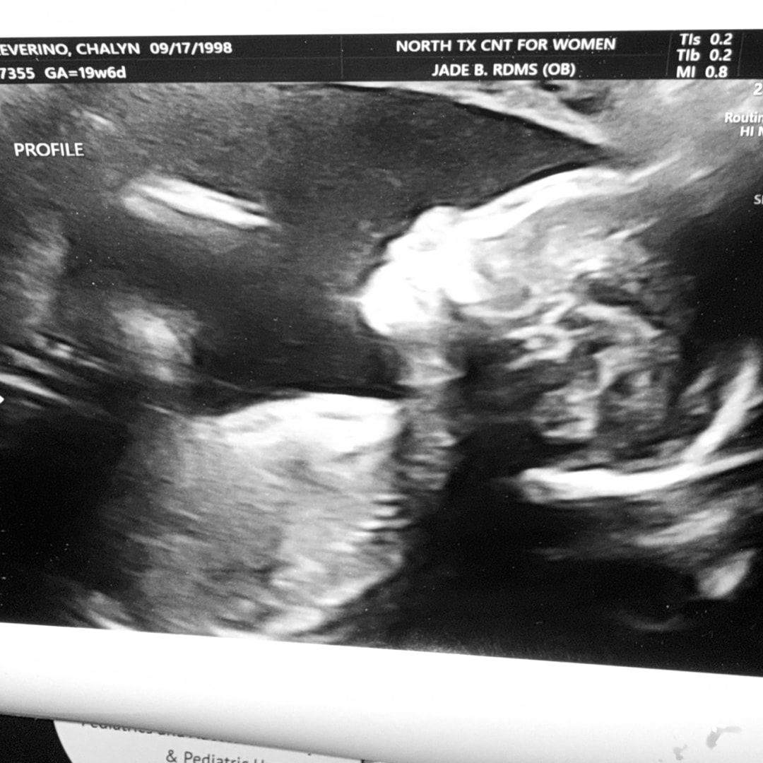 Photo shared by Chalyn for their Babylist baby registry.