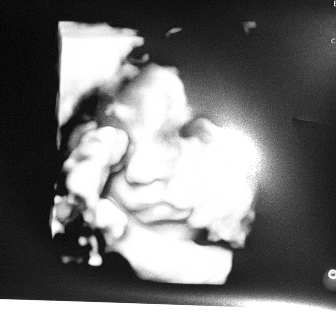 Photo shared by Payton for their Babylist baby registry.