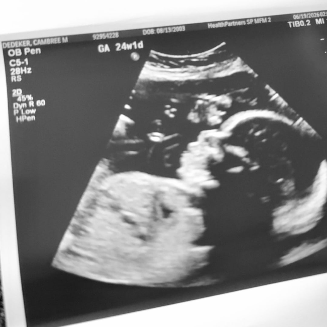 Photo shared by Cambree for their Babylist baby registry.