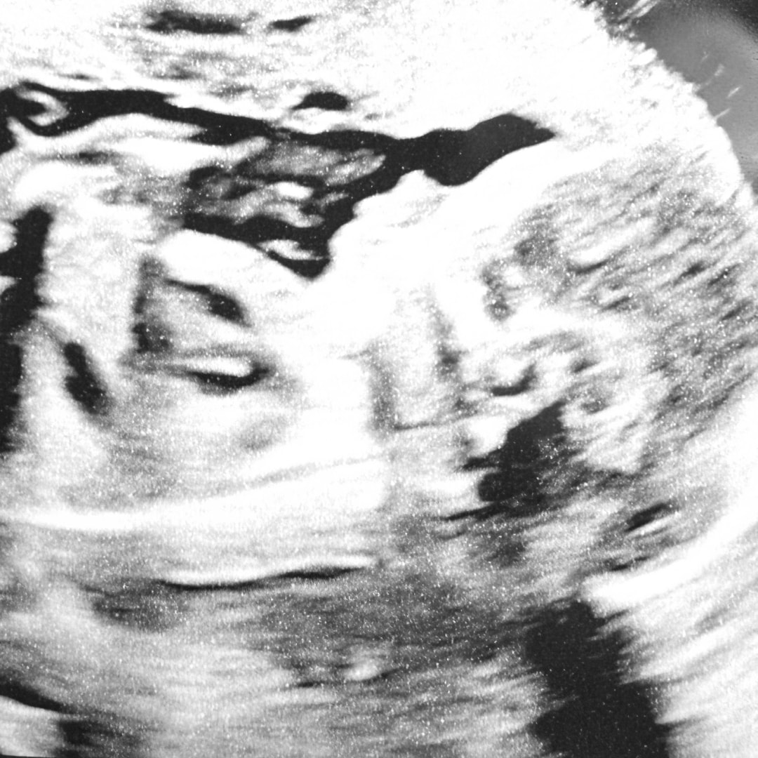 Photo shared by Lauren for their Babylist baby registry.