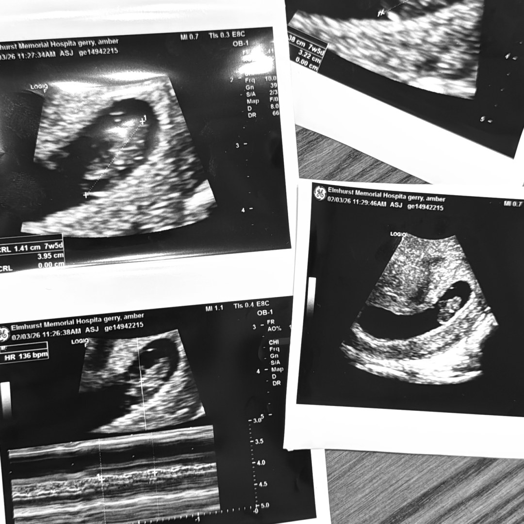 Photo shared by Amber for their Babylist baby registry.