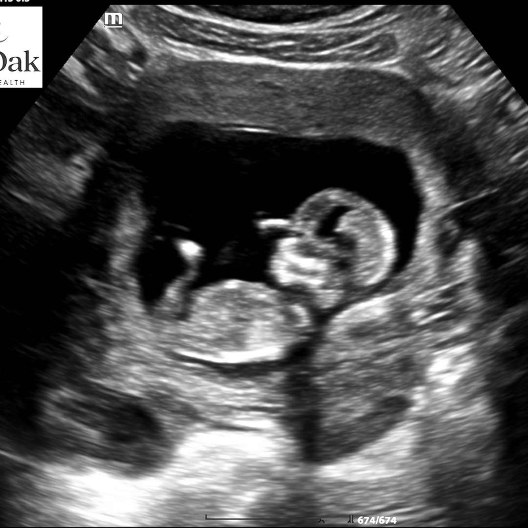 Photo shared by Ash for their Babylist baby registry.