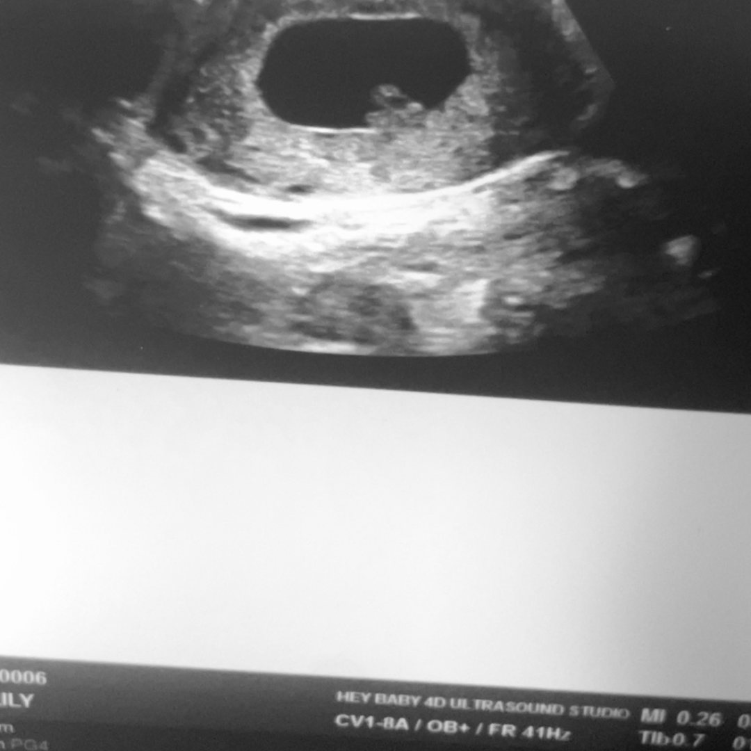 Photo shared by Lily for their Babylist baby registry.