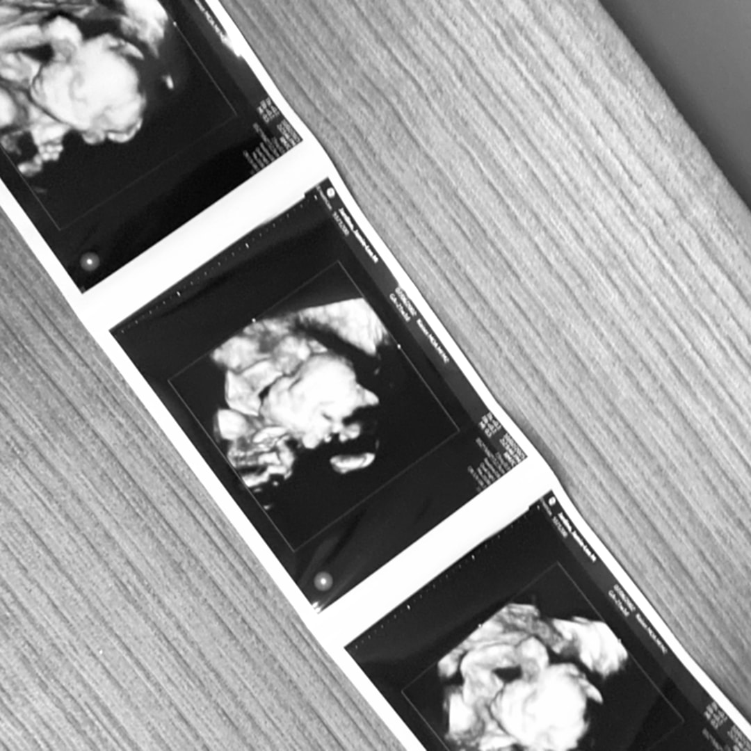 Photo shared by Jamielee for their Babylist baby registry.