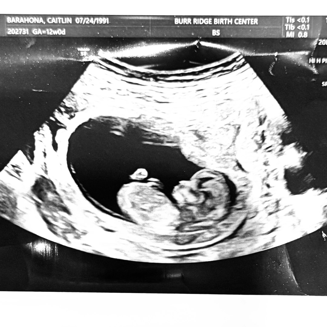 Photo shared by Caitlin for their Babylist baby registry.