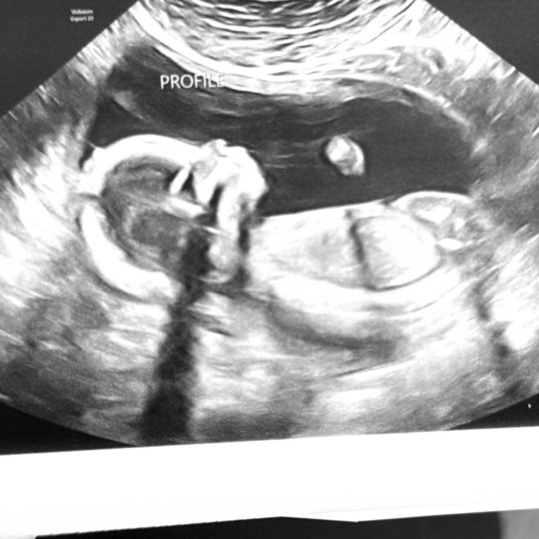 Photo shared by Nakia for their Babylist baby registry.