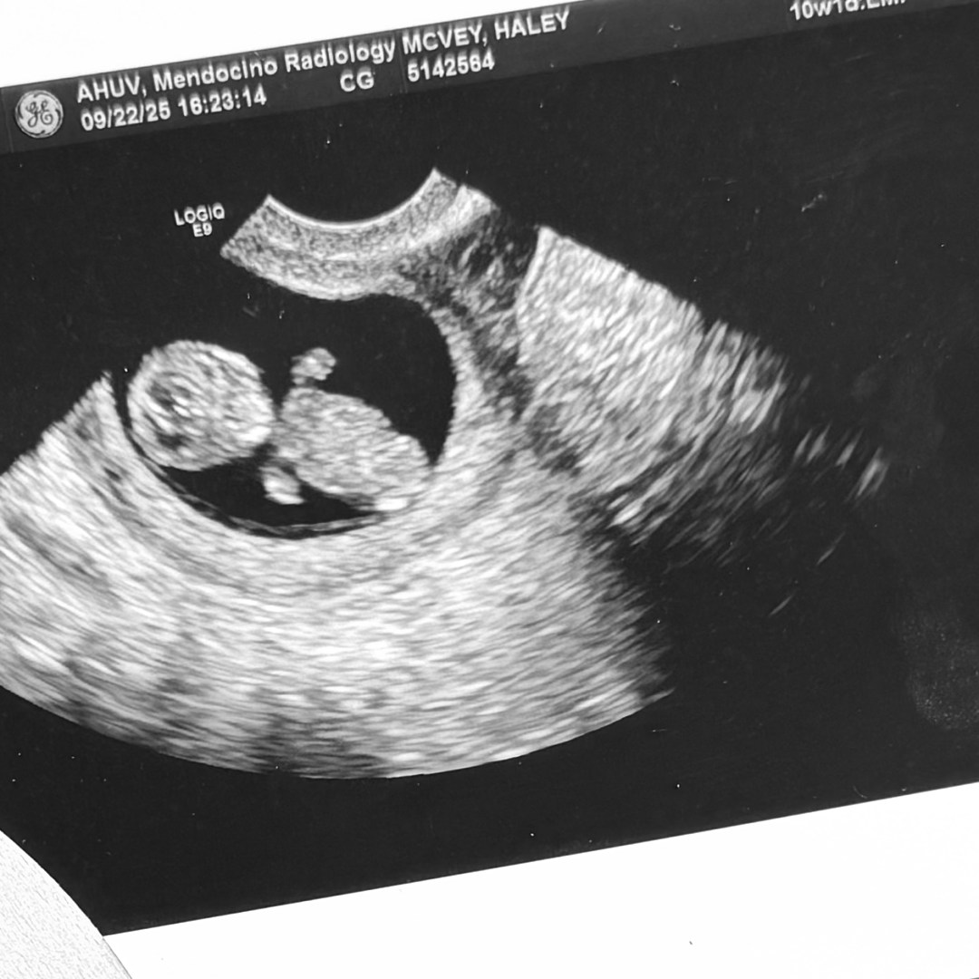 Photo shared by Haley for their Babylist baby registry.