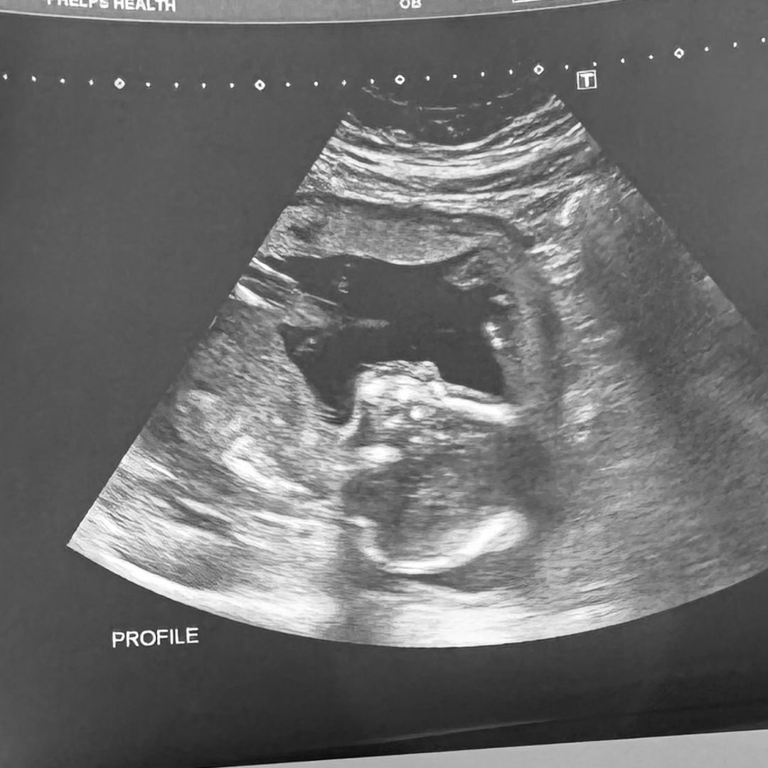 Photo shared by Mia for their Babylist baby registry.