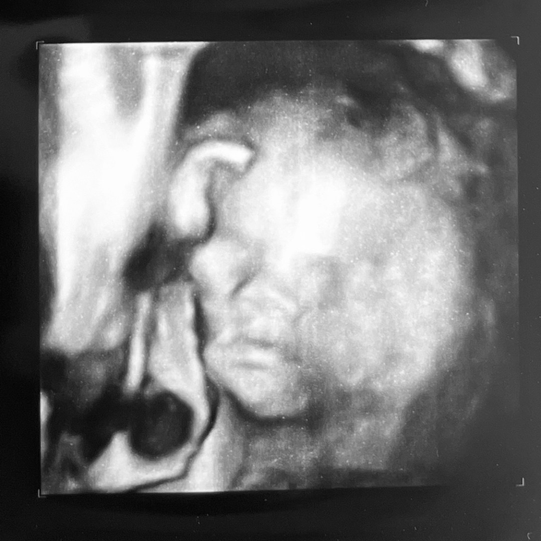 Photo shared by Kayla for their Babylist baby registry.