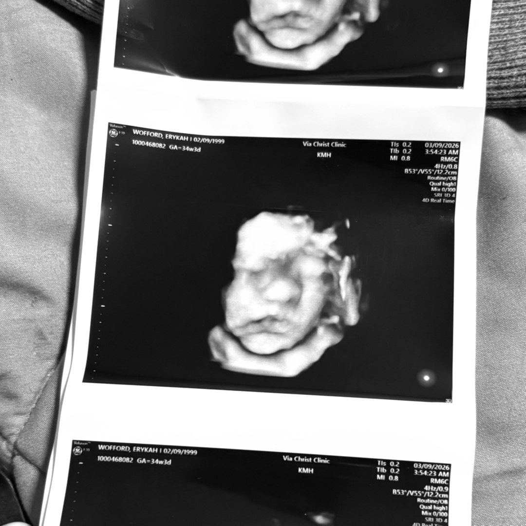 Photo shared by Erykah for their Babylist baby registry.