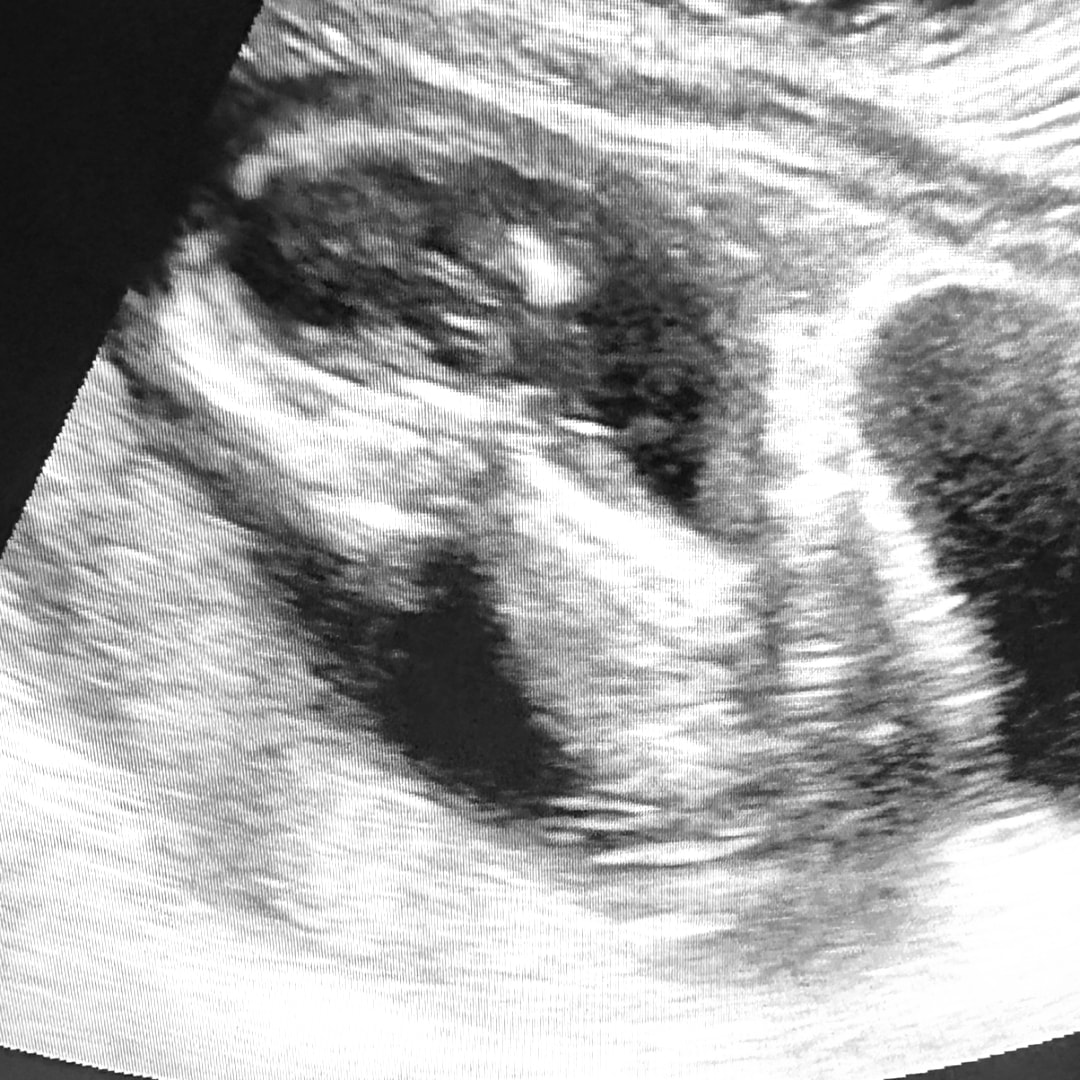 Photo shared by Samantha for their Babylist baby registry.