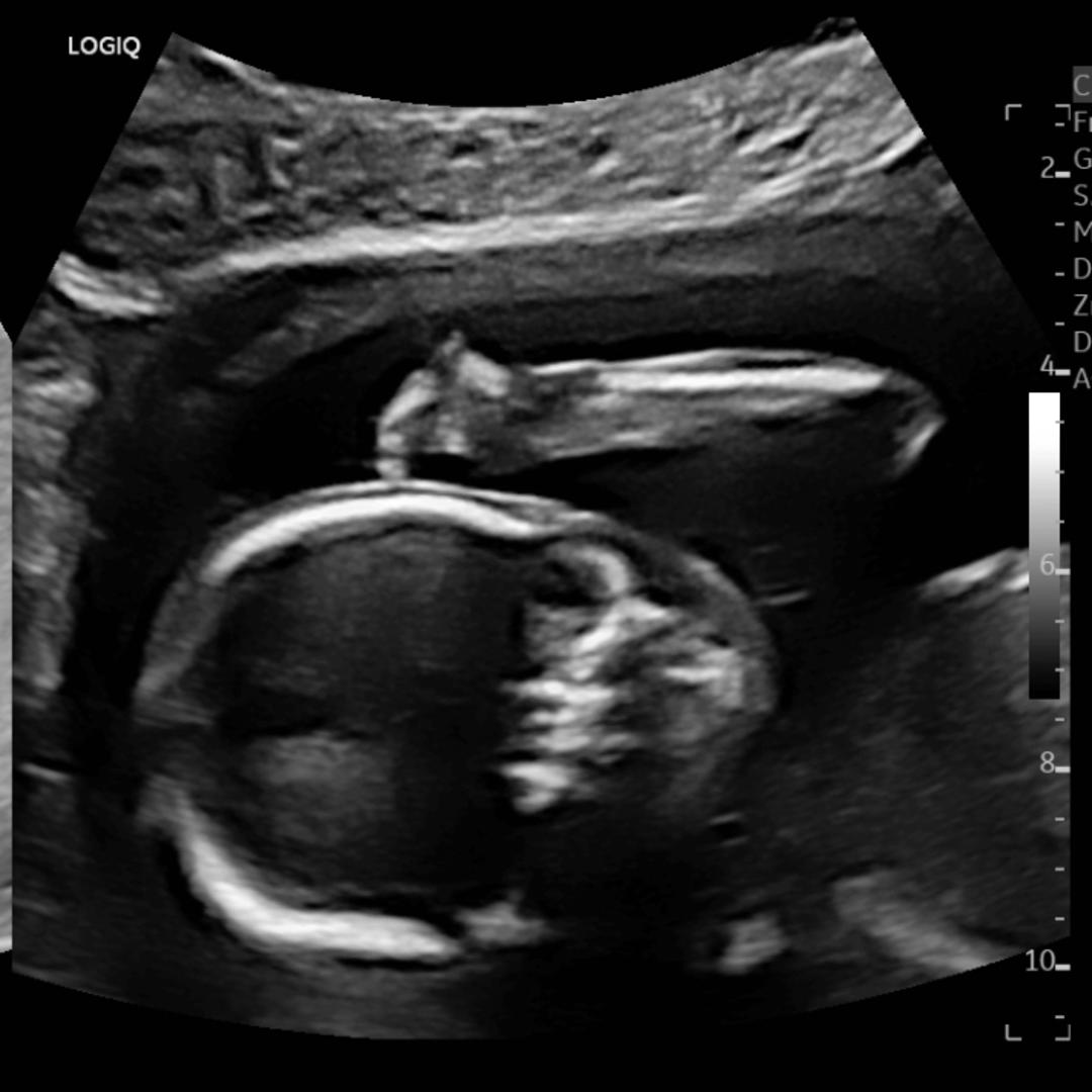 Photo shared by Asia + John for their Babylist baby registry.