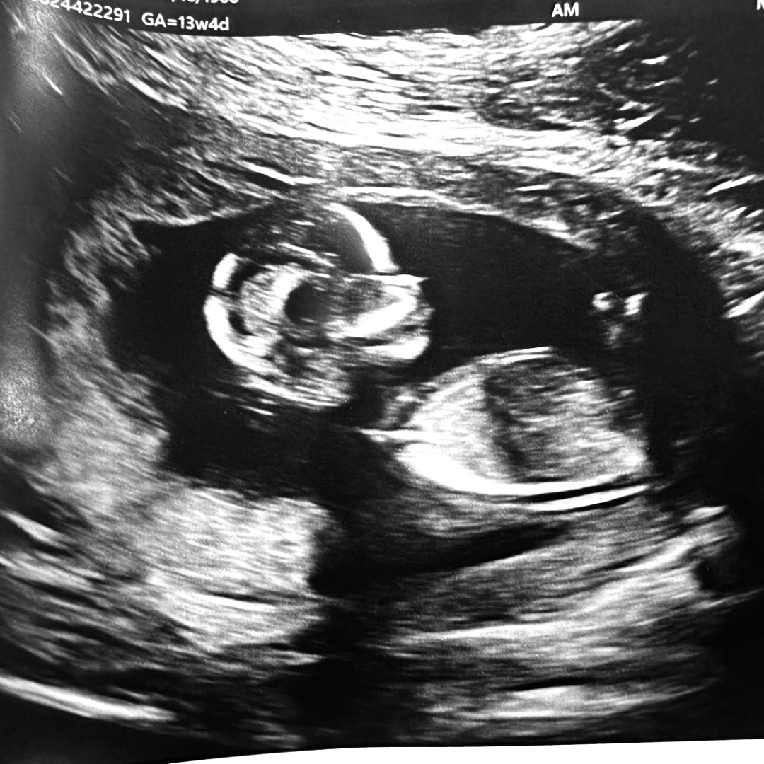 Photo shared by Beatriz for their Babylist baby registry.