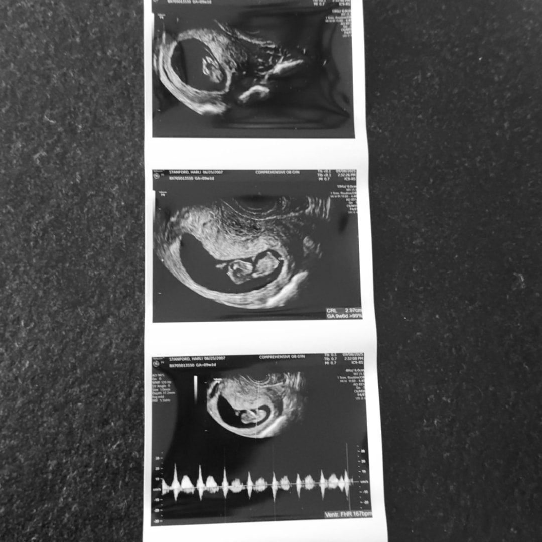 Photo shared by Harli for their Babylist baby registry.