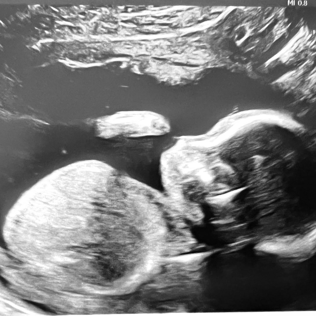 Photo shared by Jaimie for their Babylist baby registry.