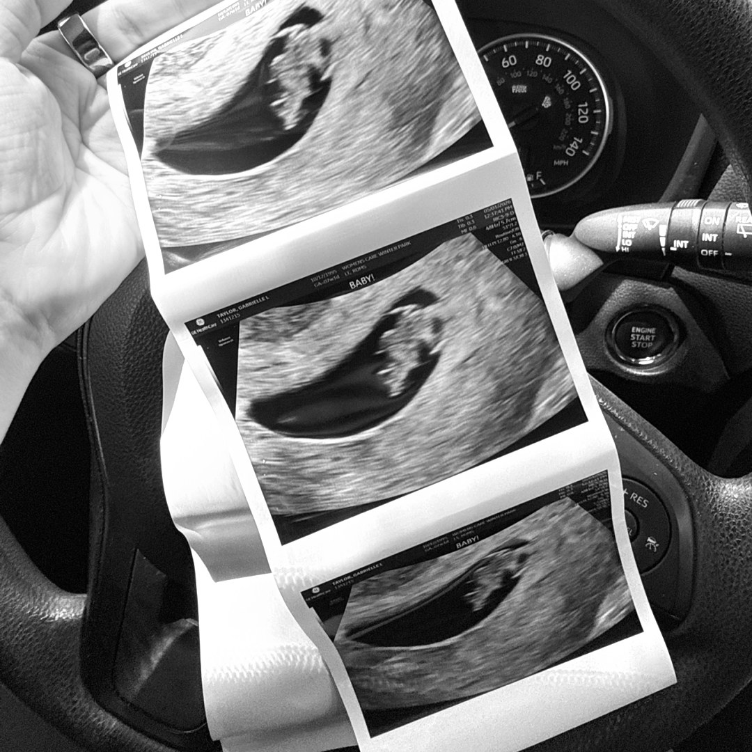 Photo shared by Gabi for their Babylist baby registry.