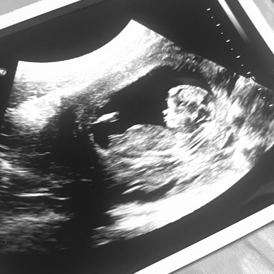 Photo shared by Eve for their Babylist baby registry.