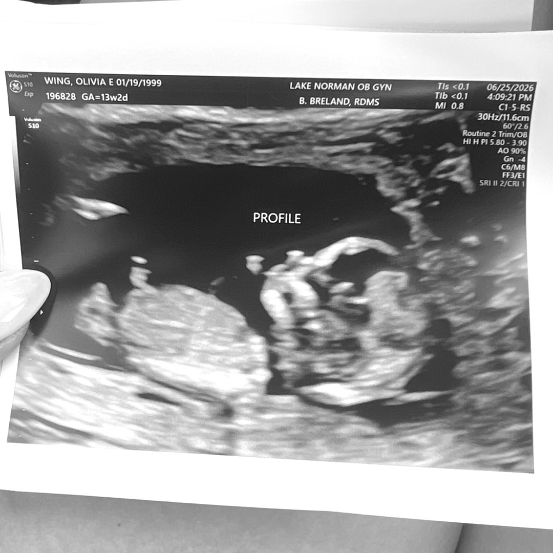 Photo shared by Olivia for their Babylist baby registry.