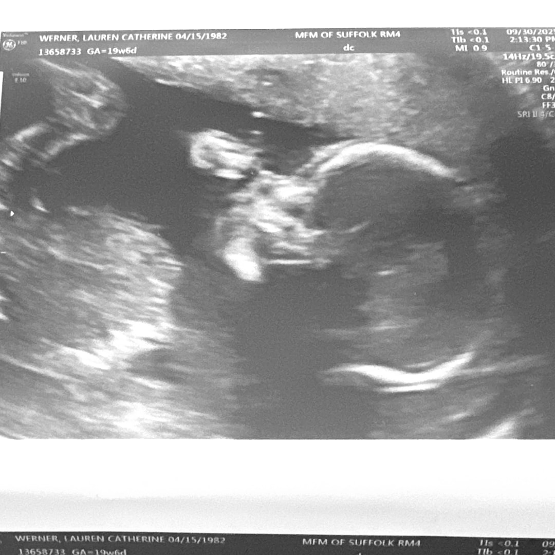 Photo shared by Lauren for their Babylist baby registry.