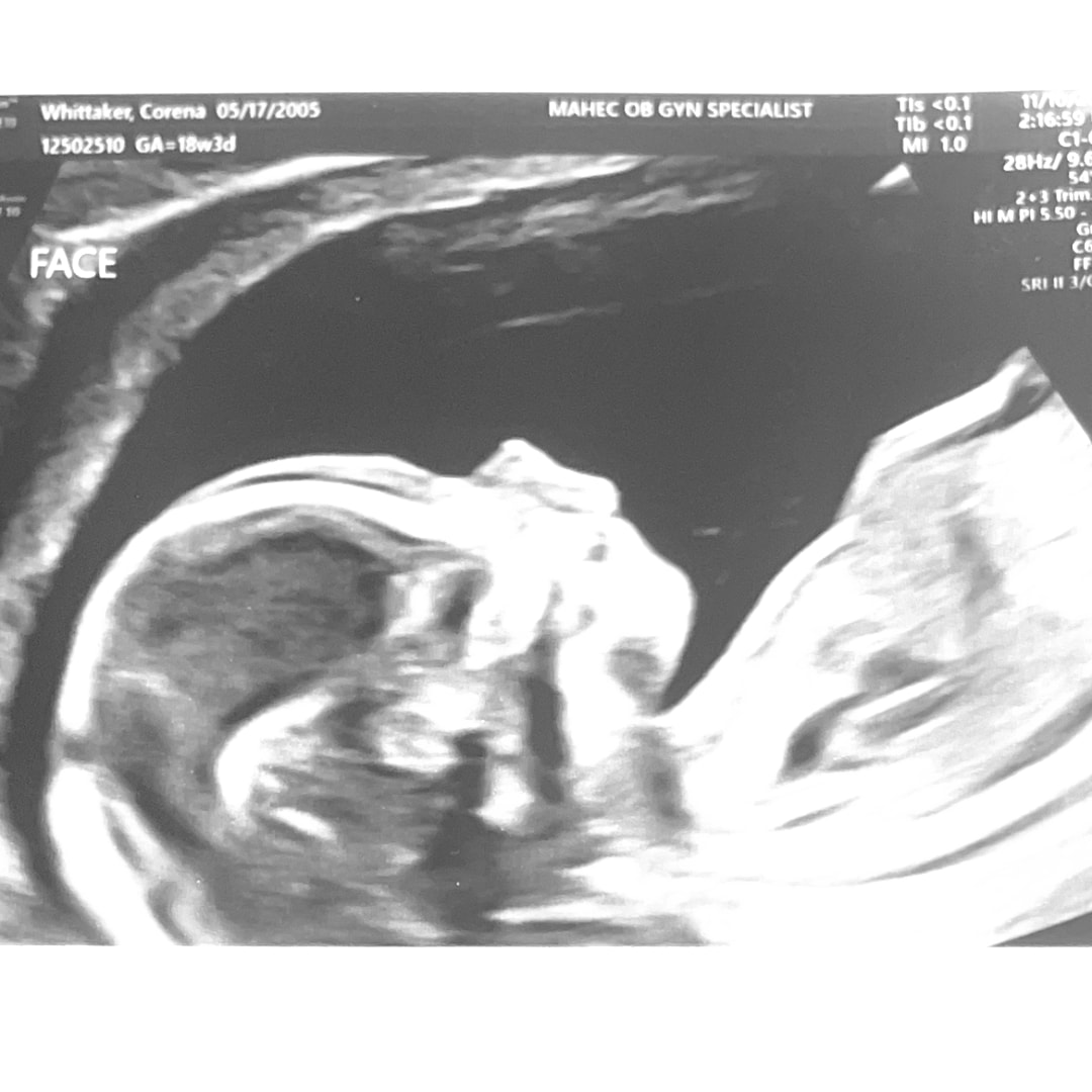 Photo shared by Corena for their Babylist baby registry.