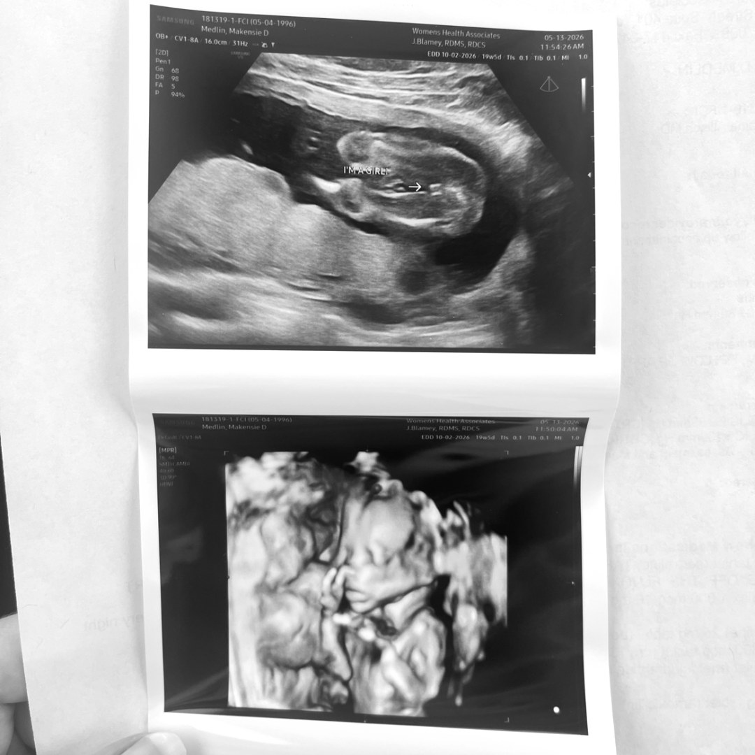 Photo shared by MaKensie for their Babylist baby registry.