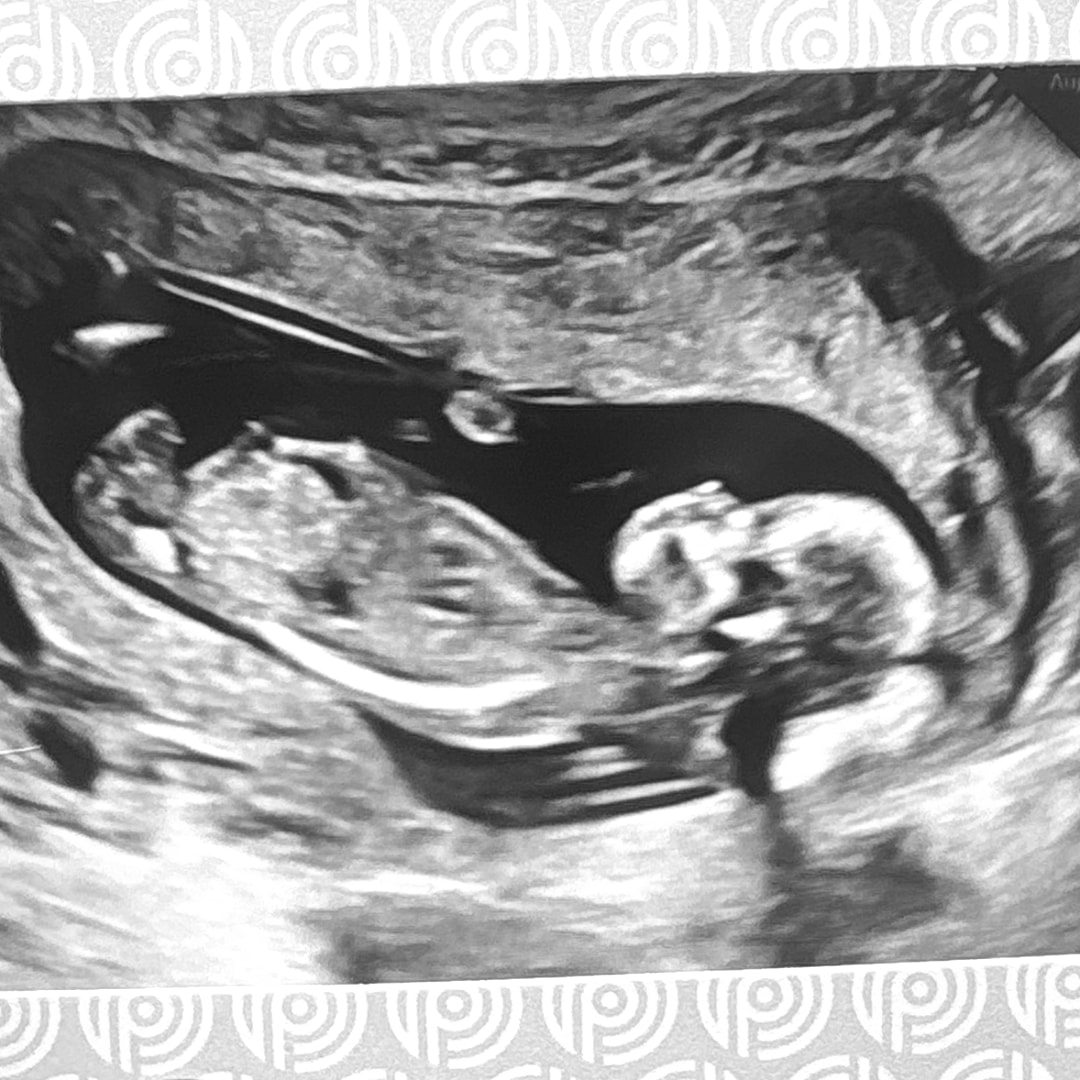 Photo shared by Alize’ for their Babylist baby registry.
