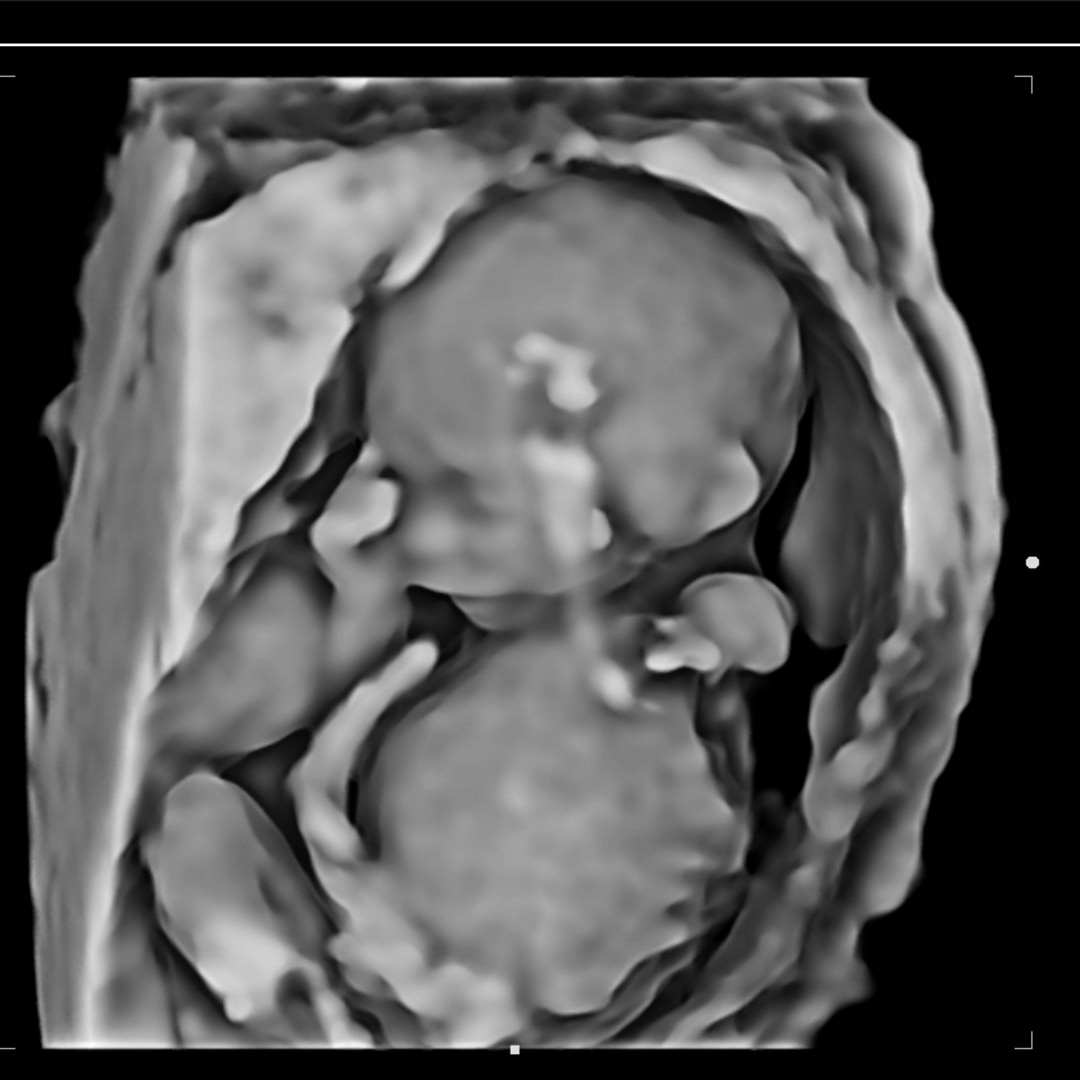 Photo shared by Hayden for their Babylist baby registry.