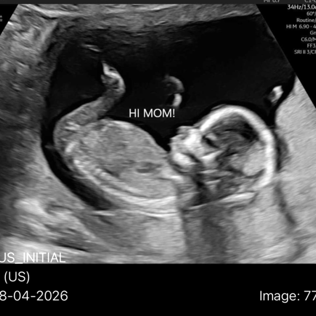 Photo shared by Dixie for their Babylist baby registry.