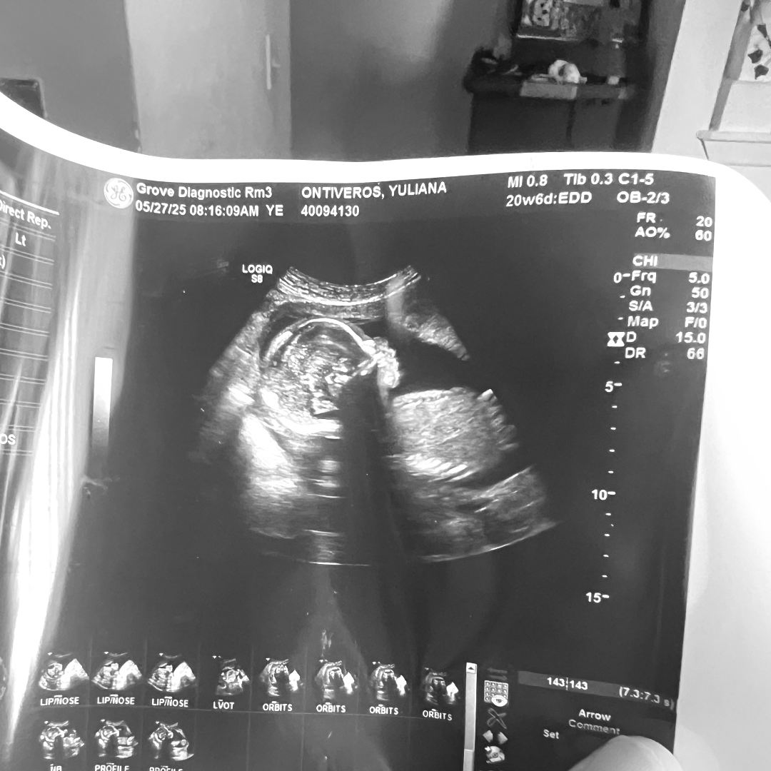 Photo shared by Yuliana for their Babylist baby registry.