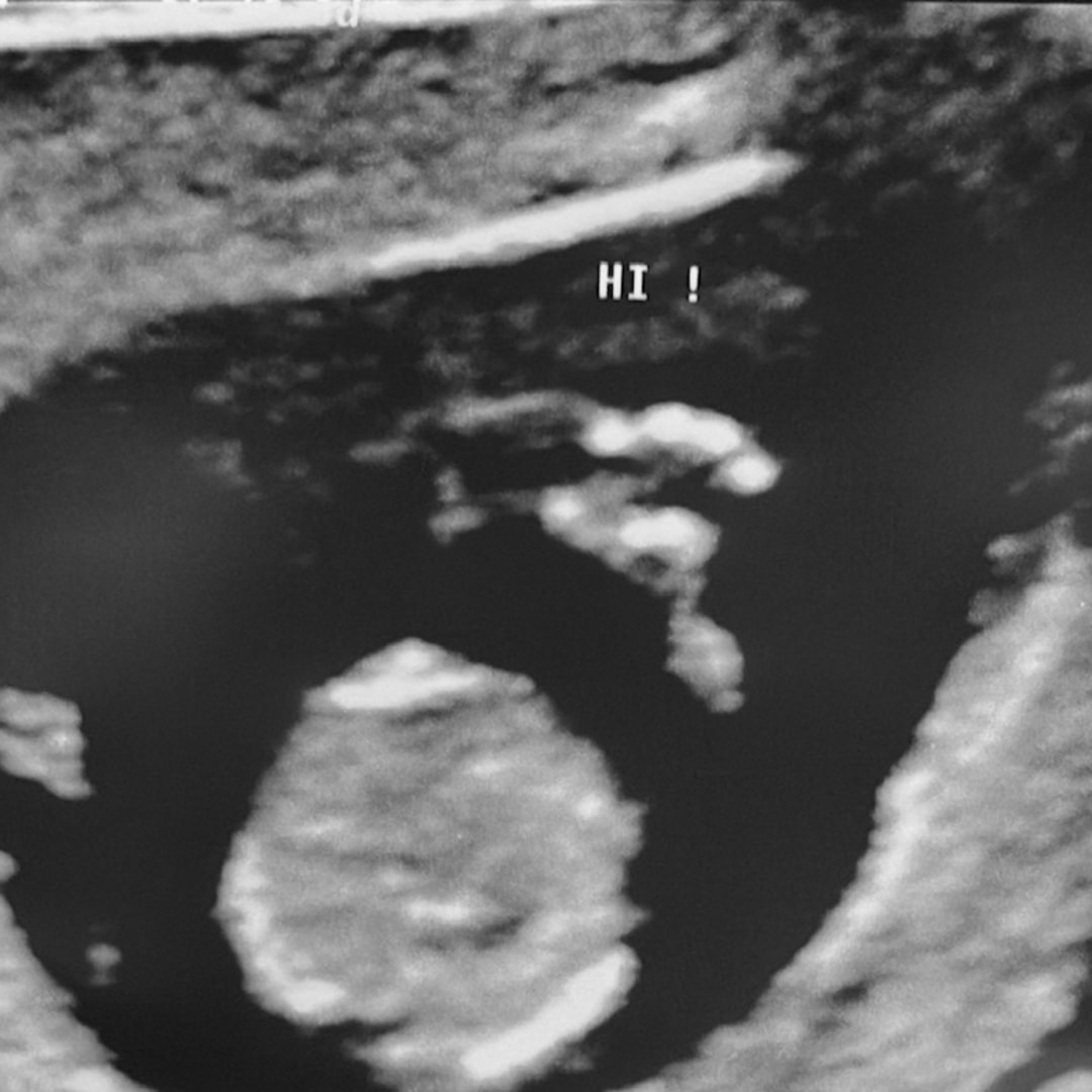 Photo shared by Janise for their Babylist baby registry.