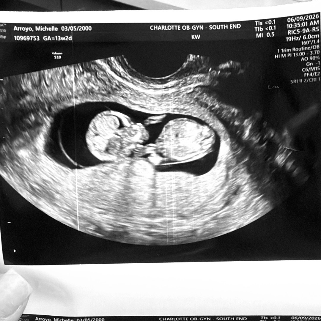 Photo shared by Michelle for their Babylist baby registry.