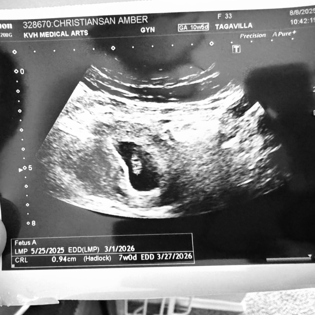 Photo shared by Amber for their Babylist baby registry.