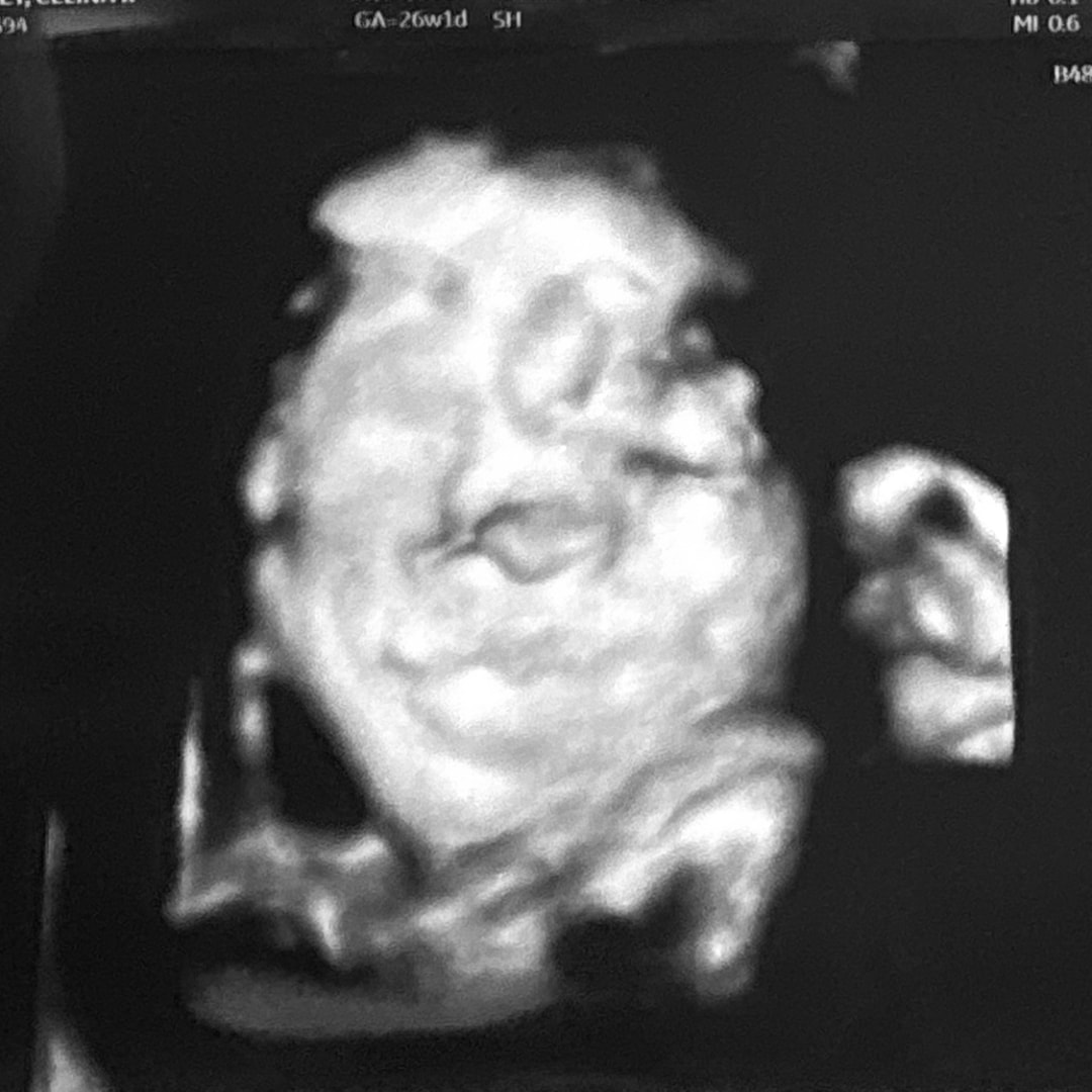 Photo shared by Dalton for their Babylist baby registry.