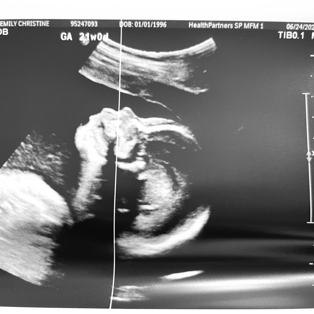 Photo shared by Emily for their Babylist baby registry.