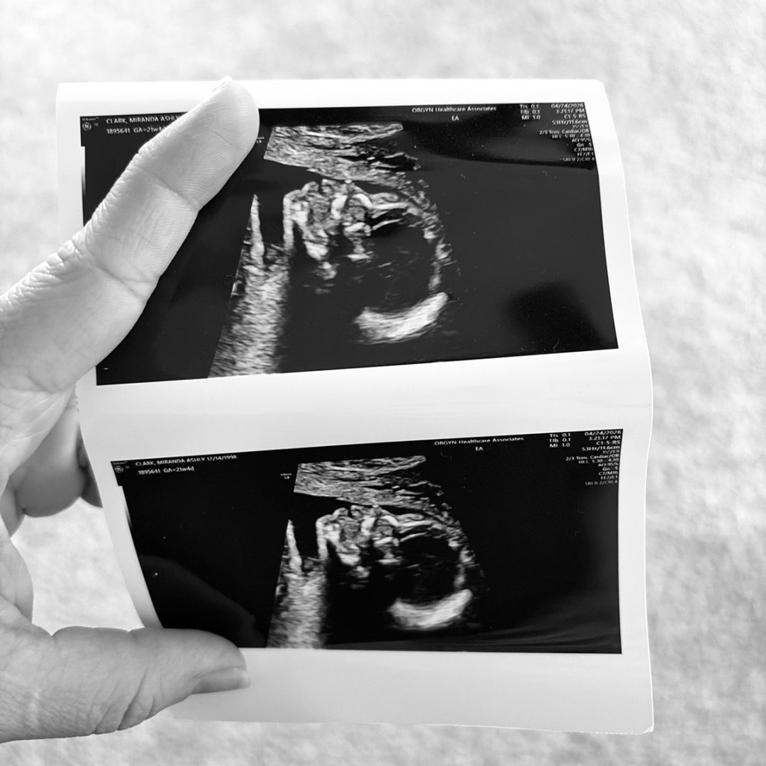 Photo shared by Miranda for their Babylist baby registry.